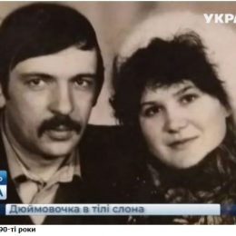 Жінці вагою 260 кг зробили операцію зі зменшення шлунка