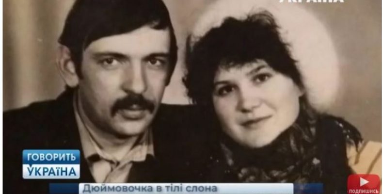 Жінці вагою 260 кг зробили операцію зі зменшення шлунка