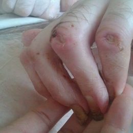 Після лікування у Греції рядовому Роману стало ще гірше
