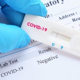 Коронавірус: 1 096 упаковок з експрес-тестами отримала Чернігівщина