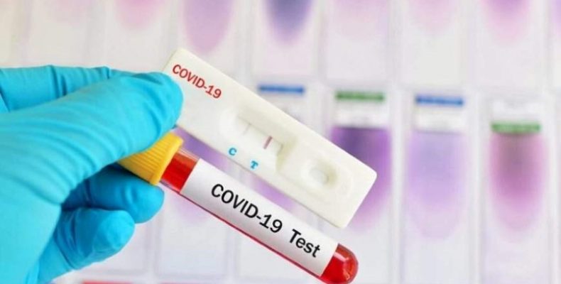 Чернігів на лікування пацієнтів від COVID-19 отримав 600 тисяч грн