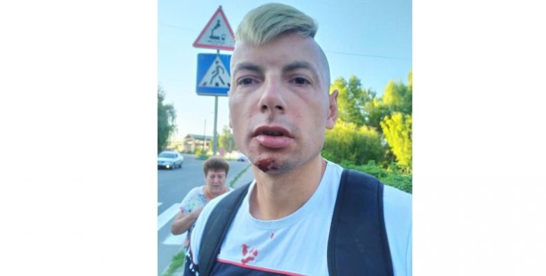 Журналіста били сильно, прицільно, руками і ногами – в голову…